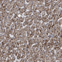 ACBD4 Antibody, Novus Biologicals:Antibodies:Primary Antibodies